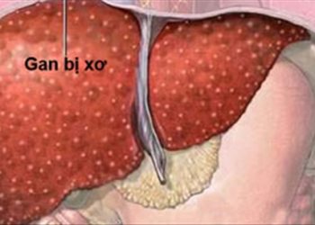 Kết thúc việc điều trị được hiệu quả nhất