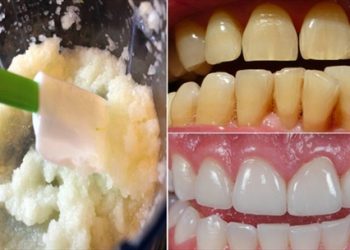Cách đánh bay mảng bám, làm trắng răng vô cùng hiệu quả