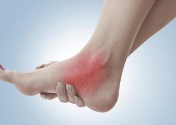 Bong gân khớp cổ chân và hướng dẫn cách xử trí hiệu quả