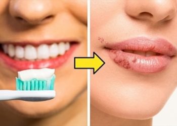 Cảnh báo 10 mẹo làm đẹp truyền miệng có thể gây hại cho sức khỏe nếu áp dụng