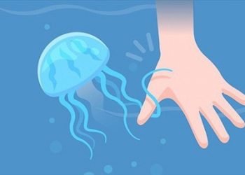 Nằm lòng cách xử lý khi bị sứa biển cắn