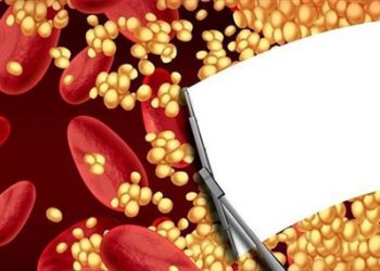 Bị mỡ máu cao để lâu gây nguy hiểm tính mạng, chuyên gia khuyên 6 điều nên làm ngay