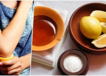 Mách nhỏ 10 mẹo làm trắng khuỷu tay và đầu gối thâm đen