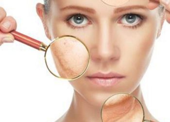 Top 6 loại kem trị nám, tàn nhang hiệu quả dành cho phái đẹp