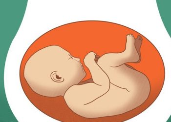 Túi thai nằm bên nào của người mẹ?