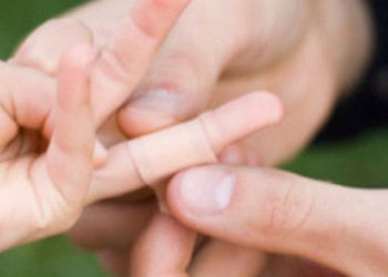 Bỏ túi 5 mẹo nhỏ giúp bạn chăm sóc vết đứt tay nhanh lành