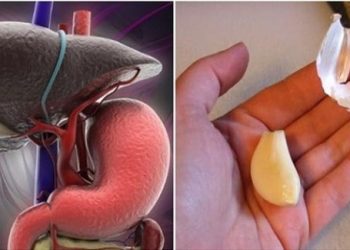 Chỉ cần ăn 1 tép TỎI vào đúng thời điểm NÀY, cả đời tế bào ung thư không bao giờ “gõ cửa” cả gia đình bạn