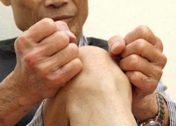 Cách chữa phong thấp tại nhà bằng chè xanh, gừng hiệu quả
