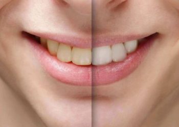 Ngậm thứ này mỗi sáng là cách trị răng ố vàng hiệu quả nhất trái đất luôn