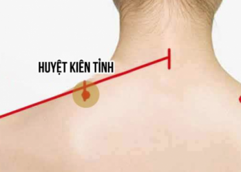 Chữa đau vai gáy bằng bấm huyệt thế nào mới hiệu quả?