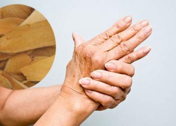 Chữa phong thấp hiệu quả bằng thảo dược quen thuộc