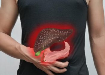 Chữa sỏi mật nhanh khỏi chỉ với những cây thuốc trong vườn
