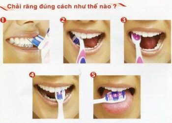 Các bước chải răng đúng cách để có hàm răng khỏe và đẹp