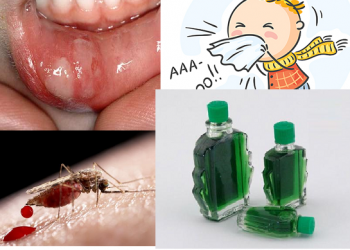 Chỉ cần vài giọt dầu gió là trị 6 căn bệnh ai cũng gặp trong mùa lạnh, nhà có con nhỏ mẹ càng phải có 1 lọ để sẵn trong nhà