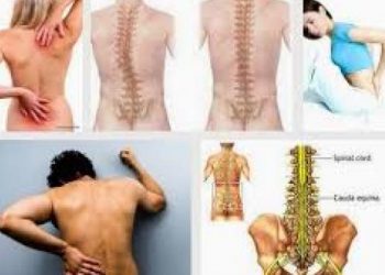 Điều trị đau thắt lưng nhanh nhất bằng những liệu pháp đơn giản