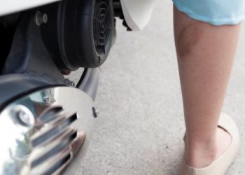 Mách bạn cách chữa bỏng bô xe máy không để lại sẹo