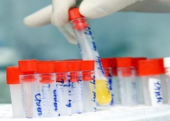 Hướng dẫn những cách chẩn đoán bệnh qua màu nước tiểu
