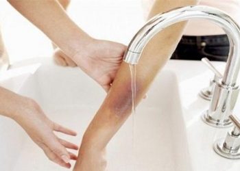 3 nguyên tắc cứu thương nhất thiết cha mẹ phải dạy cho trẻ