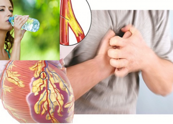 Mách bạn 3 thời điểm vàng UỐNG NƯỚC để tránh xa bệnh tim mạch và tai biến