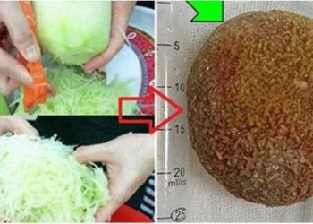 THẢI SẠCH sỏi ra ngoài trong 3 ngày nhờ dùng ĐU ĐỦ XANH theo cách này, bác sĩ cũng bái phúc vì quá hiệu quả
