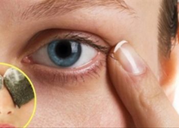 5 mẹo hay giúp giảm thâm quầng mắt có thể bạn chưa biết