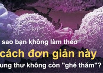 Hãy làm theo ngay, đừng lăn tăn