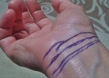 Nhìn cổ tay đoán tình trạng sức khỏe và tuổi thọ
