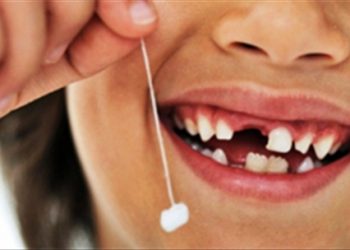 Tiềm ẩn nguy hại khi nhổ răng sữa sớm cho trẻ phụ huynh nên lưu ý