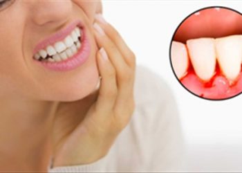 5 dấu hiệu trên khuôn mặt tố bạn đang thiếu vitamin