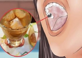 Bài thuốc quá dễ trị răng lung lay ê buốt, tới già răng vẫn không rụng