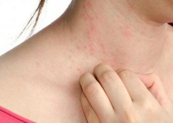 Sáu cách trị ngứa da hiệu quả ngay tức thì bạn cần biết
