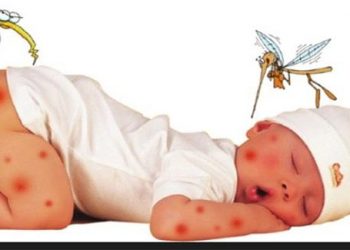 Mẹo làm bẫy bắt muỗi trong nhà hết sạch đơn giản hiệu quả để con không bị muỗi đốt