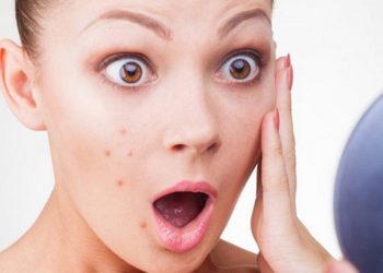 7 lưu ý trị mụn ẩn và ngăn ngừa mụn ẩn quay lại mà không phải ai cũng biết