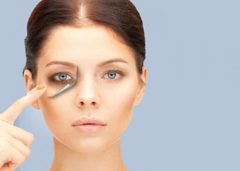 Hướng dẫn cách giảm thâm mắt hiệu quả ngay tại nhà