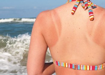 Bỏ túi ngay tuýp phục hồi da cháy nắng cực nhạy cho nàng tự tin tỏa sáng