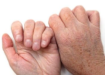 Nước rửa tay có cồn và 7 cách ngăn ngừa tình trạng nứt nẻ da tay mà bạn nên biết