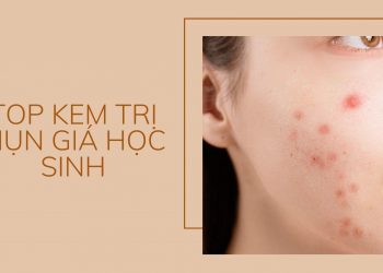 Top 7 kem trị mụn giá học sinh “ngon-bổ-rẻ”