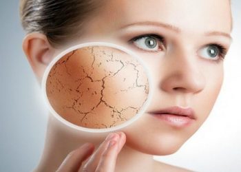 Chứng khô da có đáng lo ngại không? Cách khắc phục như thế nào?