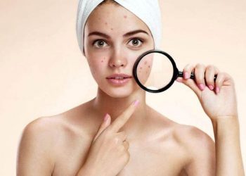 TOP 7 sản phẩm kem chấm mụn “thần thánh” các nàng nên thử