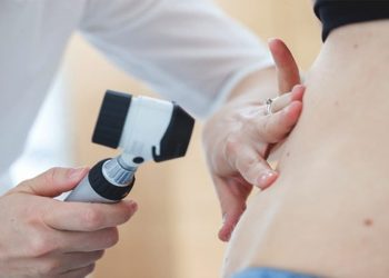 Bác sĩ Da liễu hướng dẫn cách nhận biết dấu hiệu dày sừng da dầu