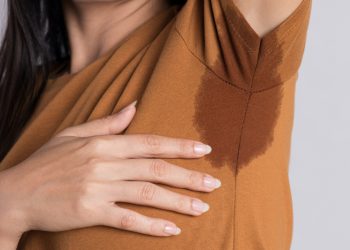 Những điều cần biết về tình trạng tăng tiết mồ hôi