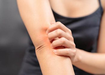Bạn đã biết sử dụng thuốc trị hắc lào đúng cách chưa?