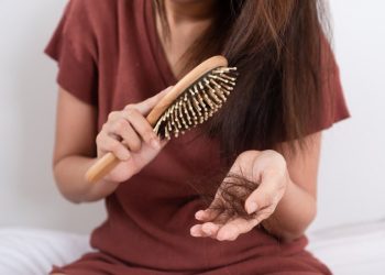 Rụng tóc nhiều là triệu chứng của bệnh lý gì?