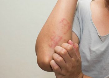 Tại sao da bị khô ngứa khi trời lạnh?