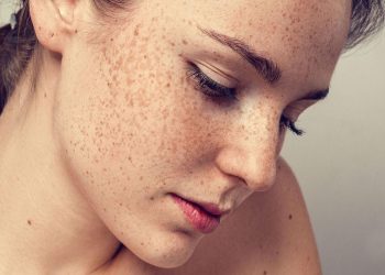 Thuốc trị nám da hỗ trợ lấy lại nét thanh xuân cho làn da