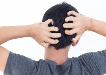 Cách trị gàu cho nam giới hiệu quả từ 5 nguyên liệu dễ tìm