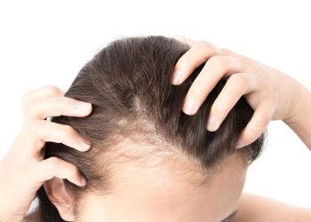 Nguyên nhân khiến tóc thưa? Biện pháp chữa tóc thưa hiệu quả