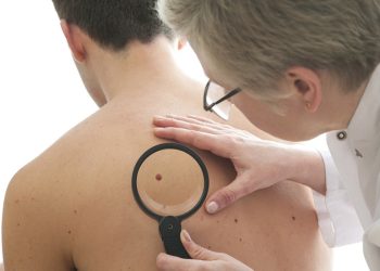 Ung thư hắc tố và những thông tin cơ bản