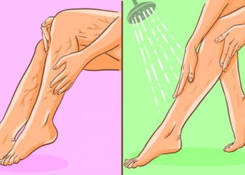 7 bài tập giúp gọn bắp chân cho người bị giãn tĩnh mạch