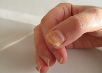 Chăm sóc móng tay cho nam tại nhà cần lưu ý những gì?